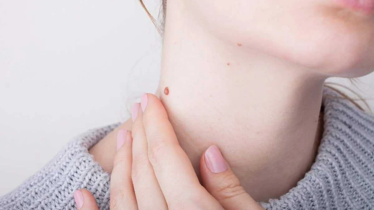 En Etkili Siğil Tedavisi Yöntemleri