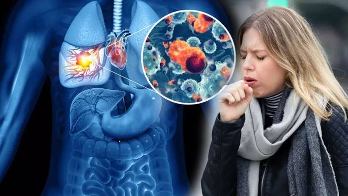 Bitmeyen öksürüğe dikkat!