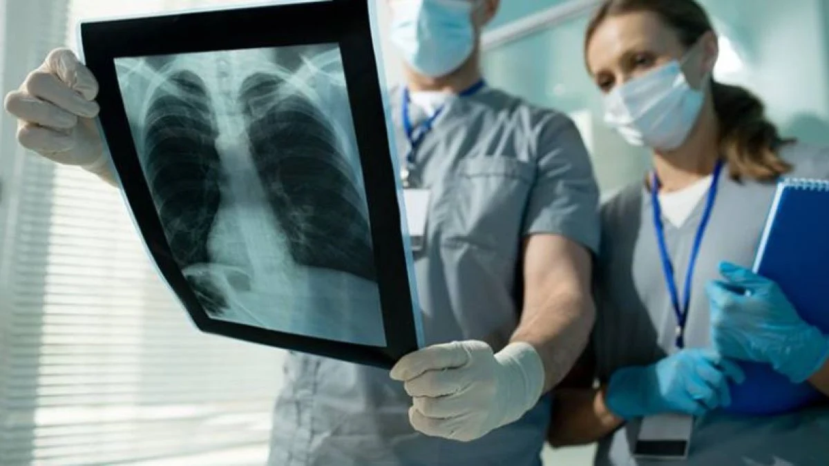 Her 4 akciğer kanserinin 3’ü sigara ile ilişkili