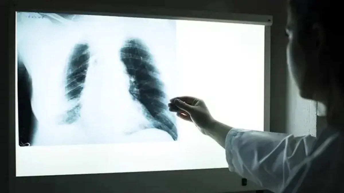 DSÖ, tüberküloz verilerini açıkladı