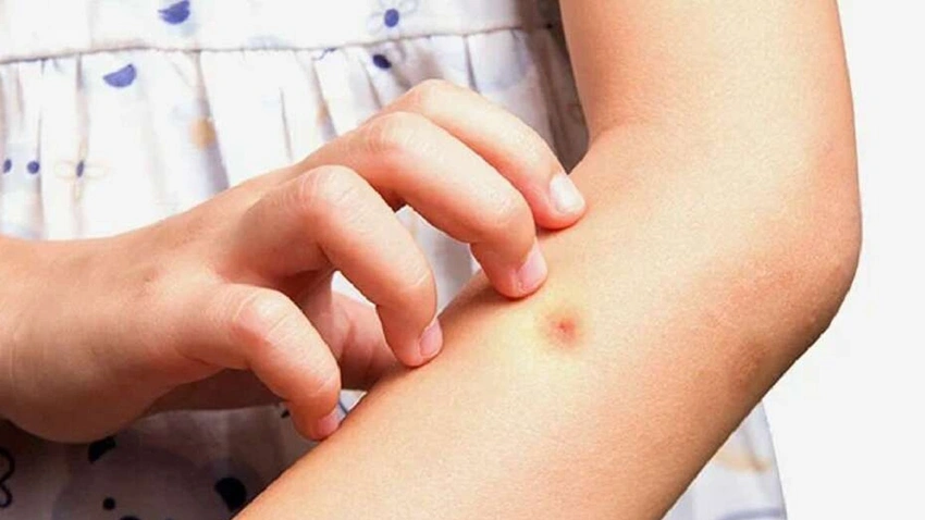 Batı Nil Virüsü Türkiye’de yeniden görüldü