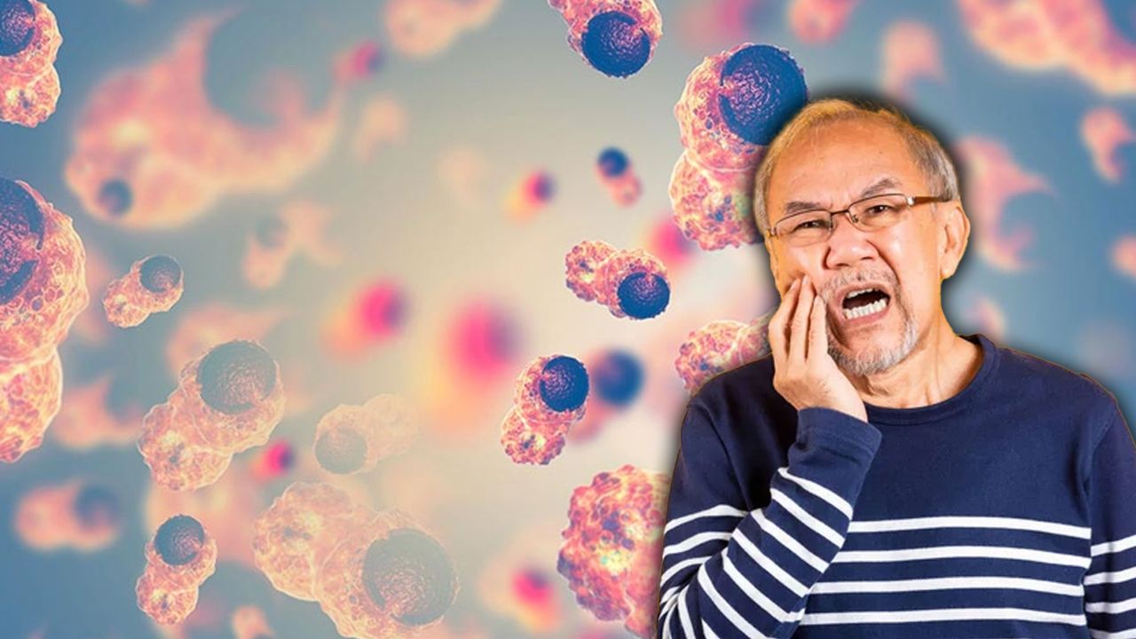 Diş ağrısı diye gitti kanser olduğunu öğrendi!