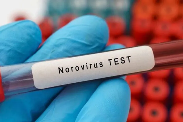 Dünyanın yeni salgını noravirüs