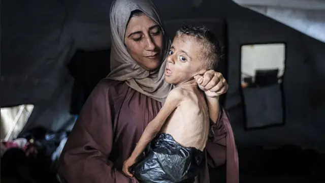 Gazze’de açlıktan ölen Filistinlilerin sayısı 455’e çıktı!