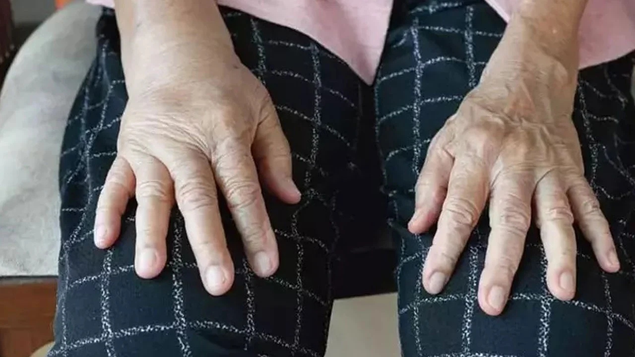 Kadınlarda sık görülüyor ama çoğu farkında değil!